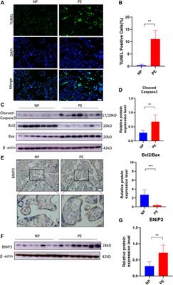 6-Gingerol alleviates placental injury in preeclampsia by inhibiting oxidative stress via BNIP3/LC3 signaling-mediated trophoblast mitophagy